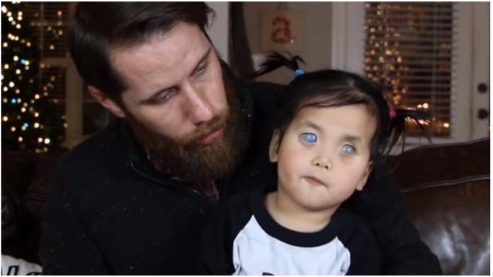 Djevojčicu sa srebrnim očima je majka ostavila nakon rođenja: Nitko je nije htio posvojiti, a onda se dogodilo čudo! (VIDEO)