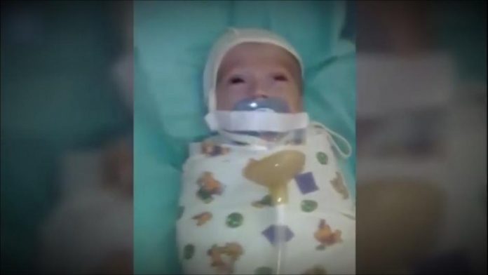 Užasna snimka iz bolnice: Bebi staroj 12 tjedana zalijepili usta ljepljivom trakom