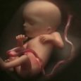 Što se dogodi kad pobačeno ili nerođeno dijete umre?