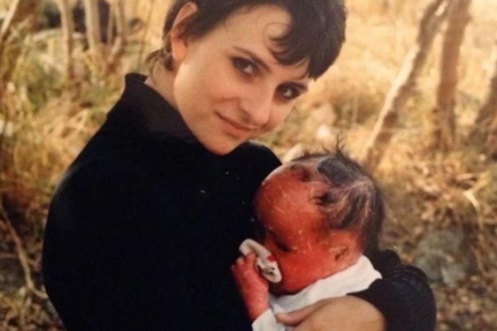 Rodila se potpuno crvena i majka ju je zbog toga OSTAVILA: A danas, 23 godine kasnije, ova beba IZGLEDA OVAKO