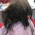 Frizerka je odbila da obrije zamršenu kosu depresivne tinejdžerke – umjesto toga ju je sređivala 13 ...