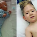 „Dijete-čudo“: Dječak rođen „bez mozga“ nastavlja prkositi svim prognozama