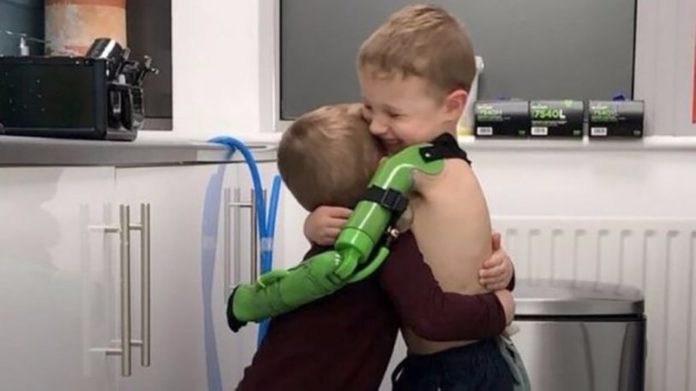 Dječak je rođen bez ruke, a danas može s obje ruke zagrliti svog brata