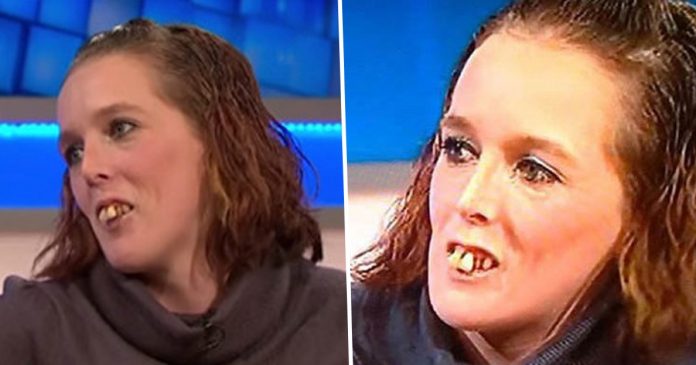 Ljudi su je vrijeđali zbog njenih zubi, a što bi rekli da je sada vide