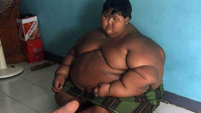 Najdeblji dječak na svijetu se prepolovio: Imao je 192 kg, a sad je neprepoznatljiv