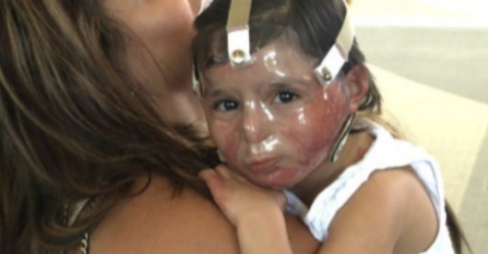 Nakon što je bundeva eskplodirala i unakazila lice njezine djevojčice, majka šalje upozorenje svim roditeljima