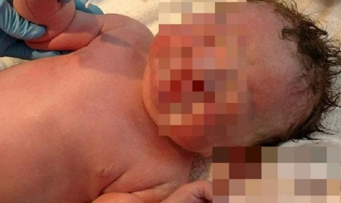 Ovo novorođenče je čudo: Kad vidite fotografiju, bit će vam jasno zašto