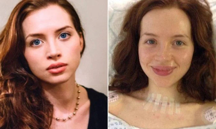 Jedna fotografija spasila joj je život: Glumica moli da zapamtite simptom raka koji je ignorirala godinu dana