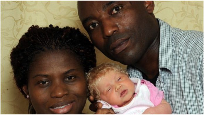 Crni par dobio bijelu bebu plave kose i očiju: Ona je naša “čudesna beba”