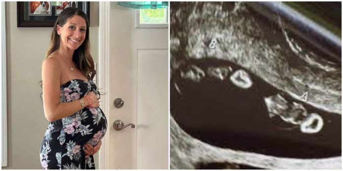 Mama doživjela šok na ultrazvuku: Nije ni slutila kakav prizor će je dočekati