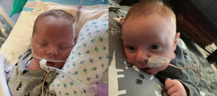 S bebe su uklonili aparate za održavanje života, a tada se dogodilo čudo koje je začudilo liječnike