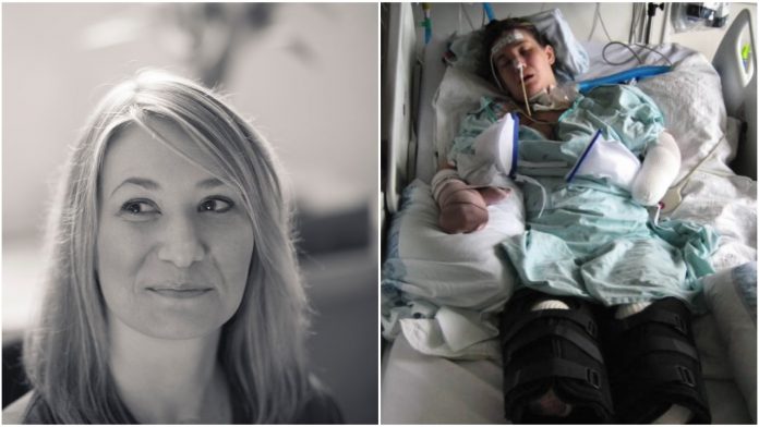 Majka je zbog infekcije izgubila noge i vid: Ovo je njezina priča