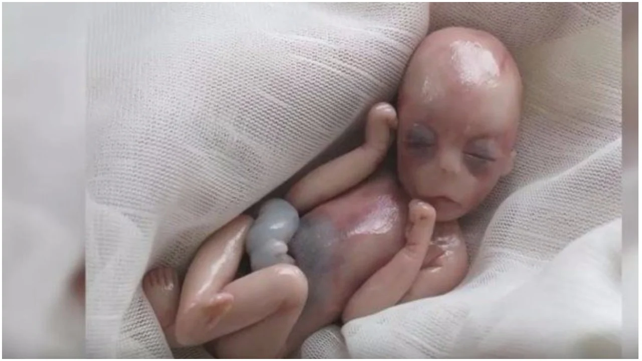 Beba od 5 mjeseci je rođena mrtva – 8 minuta kasnije, dogodilo se čudo koje je zapanjilo liječnike