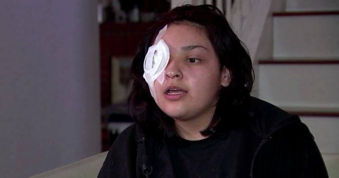Djevojka (19) izgubila oko dok je branila dječaka s posebnim potrebama od napada muškarca