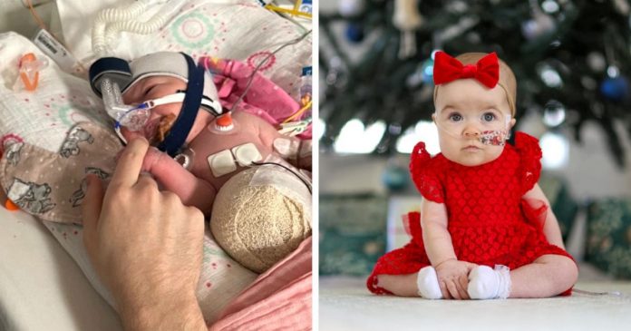 Djevojčica rođena s organima izvan tijela je dočekala svoj prvi Božić