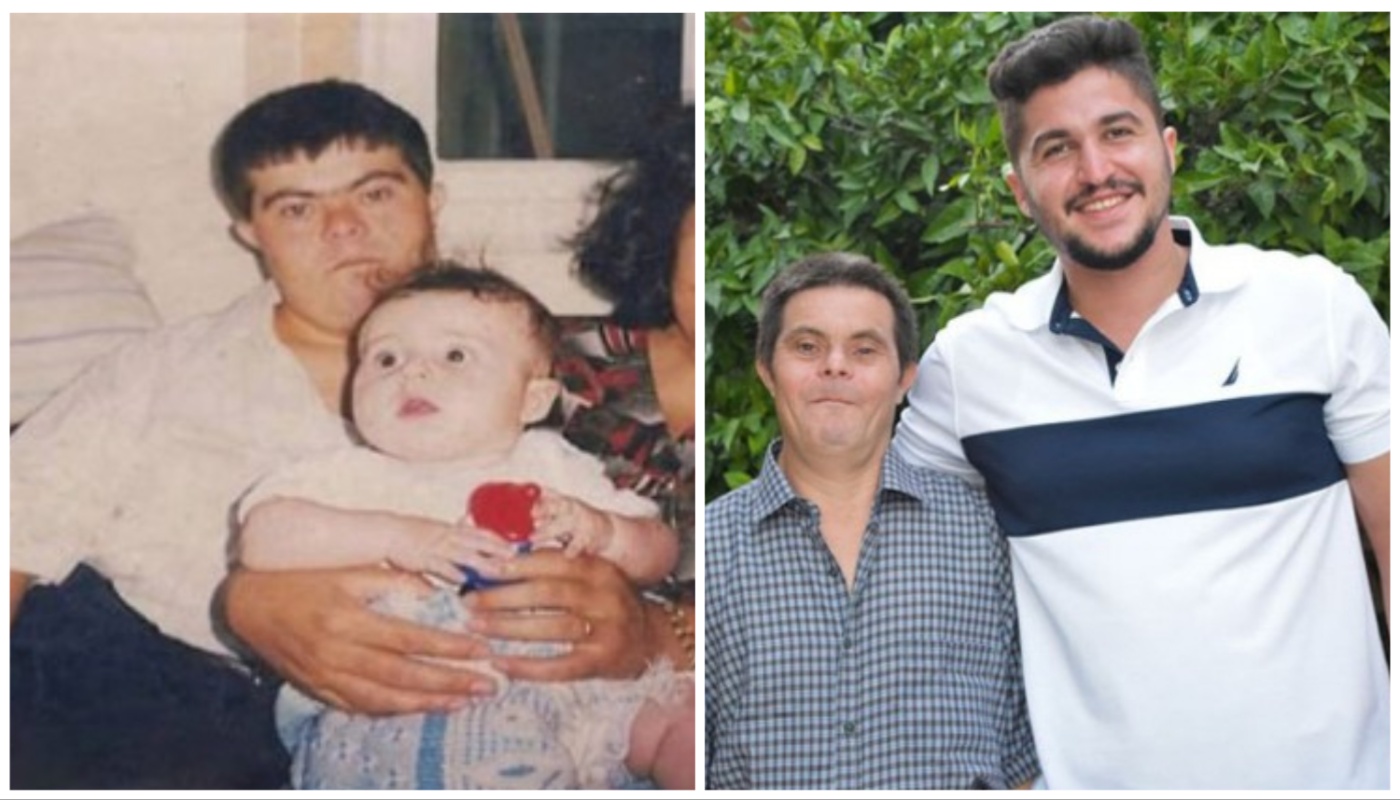 Otac s Downovim sindromom odgojio uspješnog liječnika i dokazao da je u ljubavi sve moguće